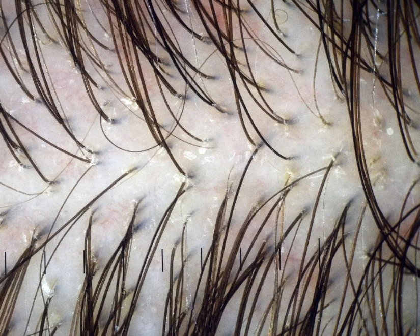 The Science of Hair Growth: How Follicles Use Nutrients to Build Stronger Strands