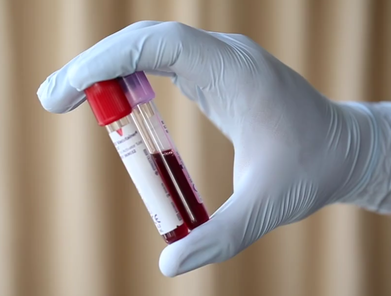 Inflammation, Oxidative Stress & Hair Thinning: What Research Suggests About Supporting Your Scalp From Within